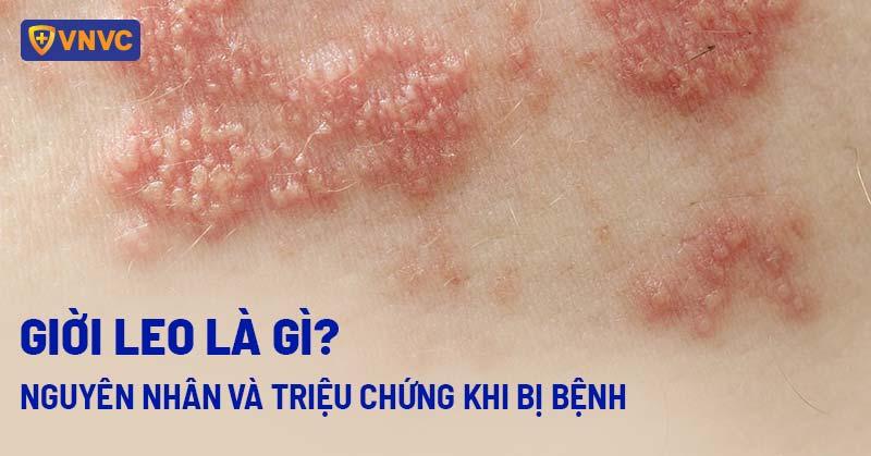 Những bông Hoa Phong Lữ đầy màu sắc, biểu tượng cho sự thanh lịch và đam mê của người sinh 11/11 cung Bọ Cạp